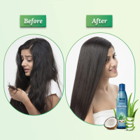 Parachute Advansed Aloe Vera Enriched Coconut Hair Oil, 250 ml