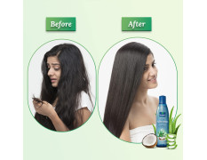 Parachute Advansed Aloe Vera Enriched Coconut Hair Oil, 250 ml