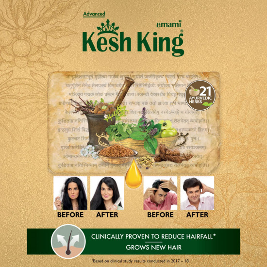 Kesh King Ayurvedic Anti Hairfall Hair Oil | Reduces hairfall |21 Natural Ingredients | Grows New Hair with Bhringraja, Amla and Brahmi - 100 ml