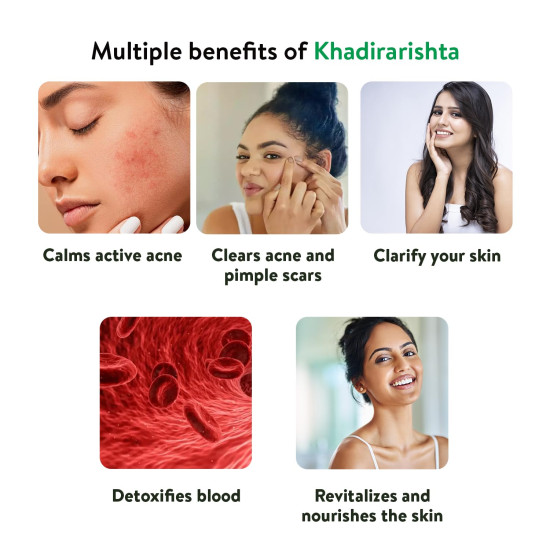 Kerala Ayurveda Khadirarishta 450ml | Herbal Blood Purifier | For Acne Relief| Tonic For Sensitive Skin| For Pimple Free Skin| Blood Purifier for Glowing Skin| 100% Ayurvedic | With Khadira, Devadaru, and Bakuchi|