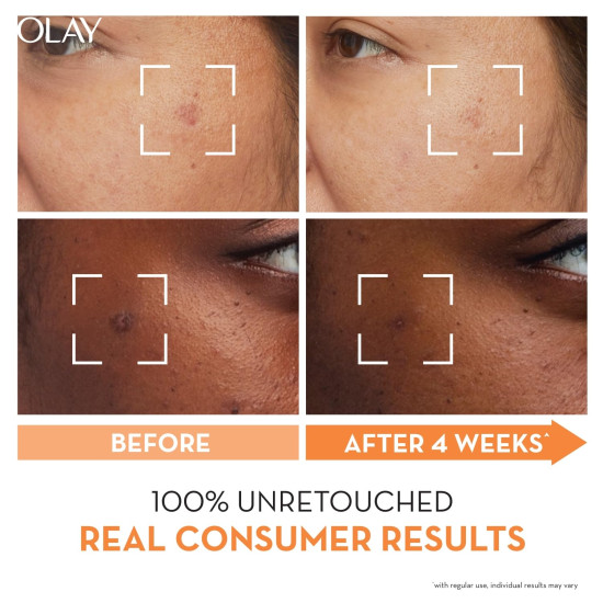 Olay Vitamin C Face Serum with Niacinamide l Even Glow & Smooth Texture l Normal, Oily, Dry & Combination Skin l Parabens & Sulphate-free l 30ml