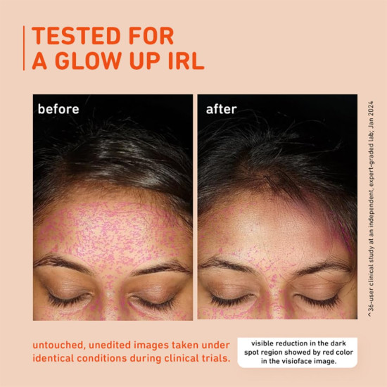 Plum 15% Vitamin C Advanced Serum for Glowing Skin | for Oily, Dry & Combination Skin | Reduce Pigmentation & Dark Spots |with Mandarin | Non-Irritating, Hydrating & Soothing | Men & Women | 20ml