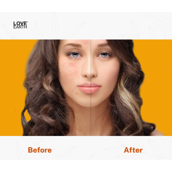 Love Earth Haldi Chandan Rose Face Pack With Amba Haldi & Chandan, For Face & Body, Paraben Free 30gm Love Earth Haldi Chandan Rose Face Pack With Amba Haldi & Chandan, For Face & Body, Paraben Free 30gm