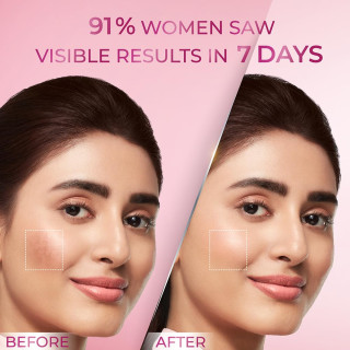 Pond's Bright Beauty Anti-Pigmentation Serum for Flawless Radiance with 12% Gluta-Niacinamide Complex - Bazaar5.com | One Stop Indian Shop Pond's Bright Beauty Anti-Pigmentation Serum for Flawless Radiance with 12% Gluta-Niacinamide Complex - Bazaar5.com | One Stop Indian Shop