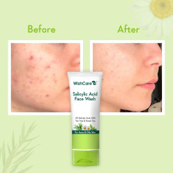 WishCare 2% Salicylic Acid Face Wash for Women & Men with AHA, GreenTea, Chamomile & TeaTree - Face Wash for Oily Skin & Acne Prone Skin 100ml