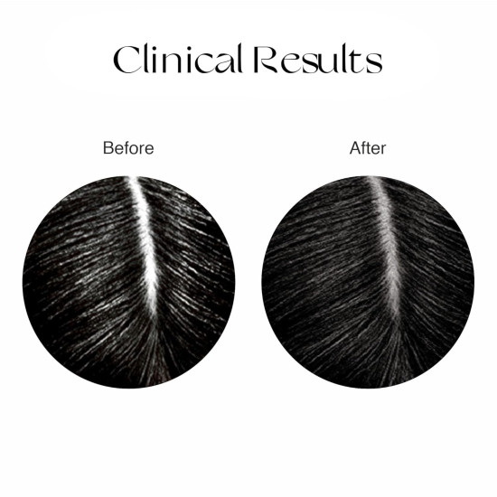 Nourish Mantra Anti-Greying Rice Water Serum with Rice Water, Arcolys & Fenugreek Extract/Effective Results Against Grey Hair & Hair Aging Signs/For Men & Women/All Hair Types - 50ml