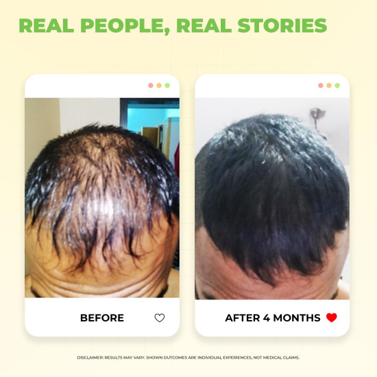 Avimee Herbal Hairtone PV 1 Scalp Tonic | Natural DHT Blocker | Hair Serum for Hair fall Control | With Rosemary, Saw Palmetto, Amla, Methi & Bhringraj Extracts | Serum For Men & Women | 100 ml