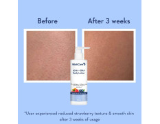 WishCare 10% AHA + 1% BHA Body Lotion for Men & Women - Body lotion for dry skin - Detans, Smooths Rough & Bumpy Skin 200ml