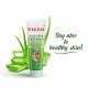 Vicco Aloe Vera Face Wash, Pure Aloe Vera Extracts, Soft, Smooth & Healthy Skin, Fights Pimples & Acne, Suitable for All Skin Types, Pack of 3 (70 gm) (3)