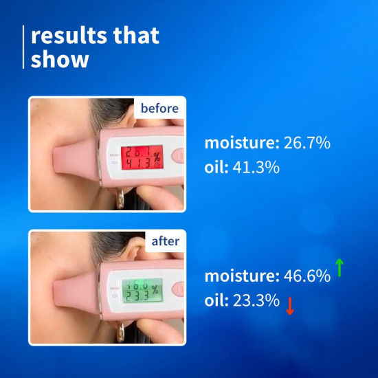 Plum 2% Niacinamide & Rice Water Superlight Gel Cream Moisturizer for Face | Oil-Free Hydration | Brightens, Fades Blemishes | Dermat-Tested | All Skin Types | Women & Men | 100% Vegan | 50 g