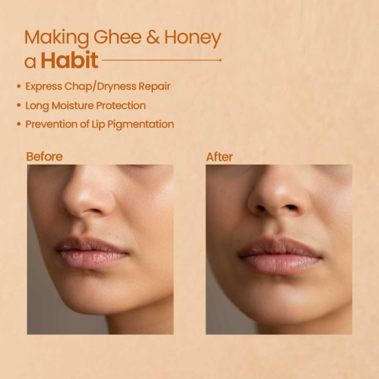 Nat Habit Kokum Honey Lip Balm Fresh Infused Lip Butter With Desi Ghee & Raw Honey For Lip Pigmentation, Lightening, Lip Repair, Dark And Chapped Lips 8gm- (Pack of 2)