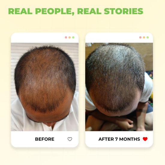 Avimee Herbal Keshpallav Hair Oil for Hair Growth | For Both Men & Women | Helps to reduce Hair Fall | With Rosemary, Castor, Amla, Coconut and Bhringraj Oil | Mineral Oil Free (Pack of 2)