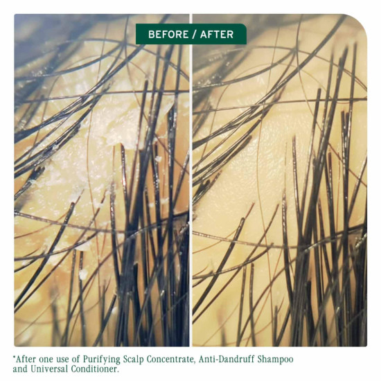 Biolage ScalpSync Oil Balancing Serum - Absorbs Excess Oil, For Oily Scalp, Soothed and Hydrated Scalp for up to 72 hours, with Fermented Tea Blend, Vegan & Paraben-Free