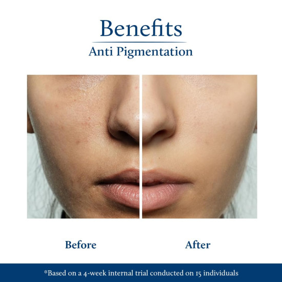 Blue Nectar Rice Water Kojic Acid Face Serum for Pigmentation & Dark Spots Removal | Anti Pigmentation Serum for Face with Mushroom (13 Herbs, 30ml)