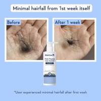 WishCare Multi Peptide Anti Hairfall Shampoo – Paraben & Sulphate Free Shampoo for Women & Men with Rice Water, Rosemary, Hyaluronic Acid & Caffeine for Hairfall Control 250ml