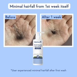 WishCare Multi Peptide Anti Hairfall Shampoo – Paraben & Sulphate Free Shampoo for Women & Men with Rice Water, Rosemary, Hyaluronic Acid & Caffeine for Hairfall Control 250ml