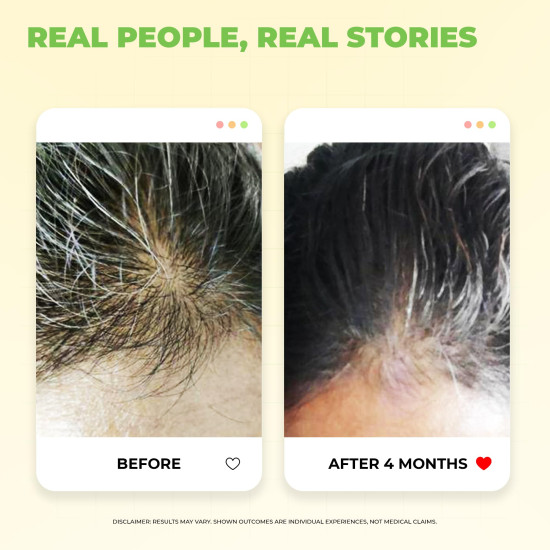 Avimee Herbal Scalptone Grey Hair Serum with Hyaluronic Acid & Caffeine | Toxin Free | Light-weight, Non-sticky & Odourless formula | For All hair types | 25 ml