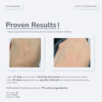 Elvey Essentials Glo 2% Kojic Acid Brightening & De Tan Body Wash | Glutathione, Glycolic Acid & Arbutin For Body Brightening, Tan Removal & Glow (200Ml)