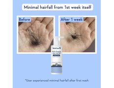 WishCare Multi Peptide Anti Hairfall Conditioner | Controls Hair Fall, For Frizzy Hair & Dry Hair | With Rice Water, Rosemary, Capilia Longa, Hyaluronic Acid & Caffeine | For Women & Men | 200ml