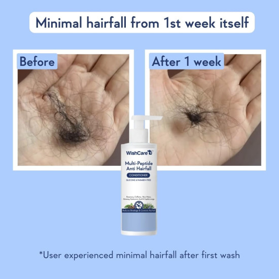 WishCare Multi Peptide Anti Hairfall Conditioner | Controls Hair Fall, For Frizzy Hair & Dry Hair | With Rice Water, Rosemary, Capilia Longa, Hyaluronic Acid & Caffeine | For Women & Men | 200ml