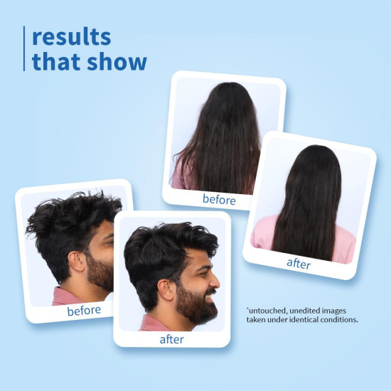 Plum Coconut Milk & Peptides Shampoo for Dry & Frizzy Hair | Provides 22X Shiny & Softer | Paraben-Free | Hair Shampoo for Women & Men | for Straight, Wavy & Rough Hair | pH Balanced | 500ml