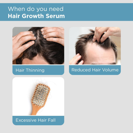 The Man Company Hair Growth Serum for Man (30ml) with 3% Redensyl, 4% Anagain, 3% Biacapil | Stimulates Hair Growth | Prevents Hair Fall | Improves Hair Strength The Man Company Hair Growth Serum for Man (30ml) with 3% Redensyl, 4% Anagain, 3% Biacapil | Stimulates Hair Growth | Prevents Hair Fall | Improves Hair Strength