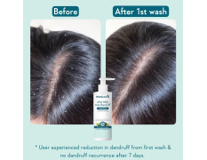 WishCare Hydrating Anti Dandruff Shampoo | 100% Dandruff Reduction | Removes Flakes & Hydrates Scalp | Proven Clinically | Piroctone Olamine, Salicylic Acid, AHA & BHA | Paraben & Sulphate Free | For Women And Men | 250ml