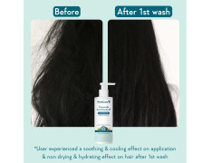 WishCare Ceramide Anti Dandruff Conditioner | Reduces Dandruff & Scalp Itchiness | Conditioner For Dry Hair, Frizzy Hair | With Piroctone Olamine & Hyaluronic Acid | 200ml