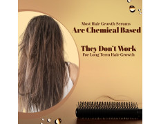 Zandu Hair Growth Serum (200Ml): Clinically Proven To Promote Hair Growth & Reduce Hair Fall In 28 Days |Strengthen Hair |Reduce Dandruff|Control Frizz|Hair Shine|For Men & Women