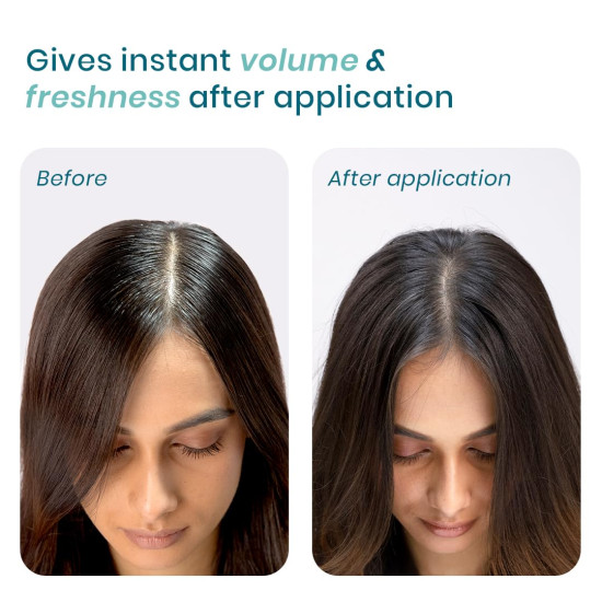 WishCare Air Powder Dry Shampoo for Oily Hair & Scalp - No White Cast & Aerosol - Niacinamide, Probiotics, Kaolin Clay, Rice & Tapioca Starch - Volume Boost, Scalp Refresh & Reset 10gm